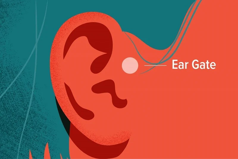 نقطه Ear gate