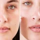 How plump up your lips with cinnamon 10 steps