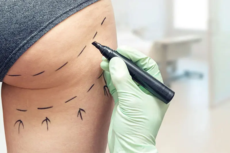 خطرات احتمالی تایپلاستی