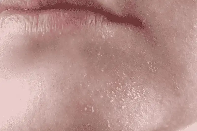 علائم پوست کم‌آب