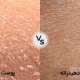 تفاوت پوست خشک و پوست دهیدراته