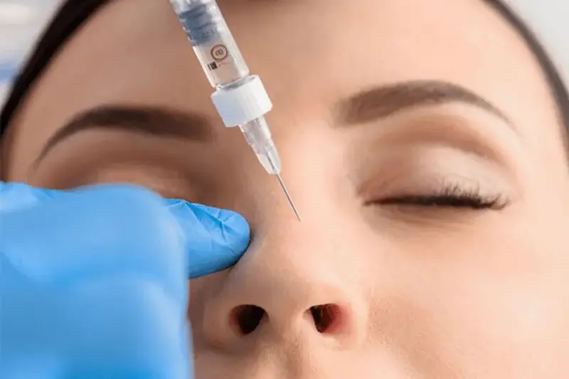 - تزریق بوتاکس و فیلر قبل از جراحی بینی 1