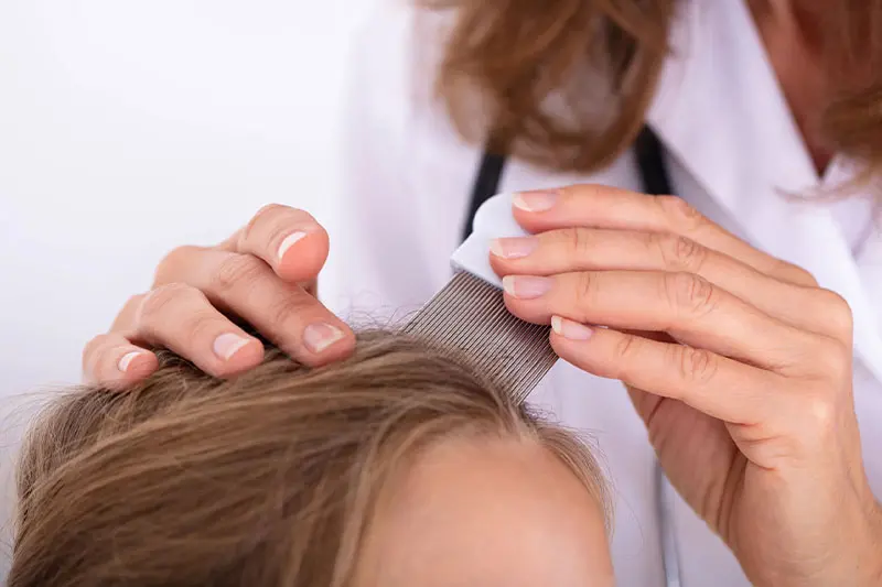 نکات ایمنی و مراقبت پس از درمان شپش با سرکه