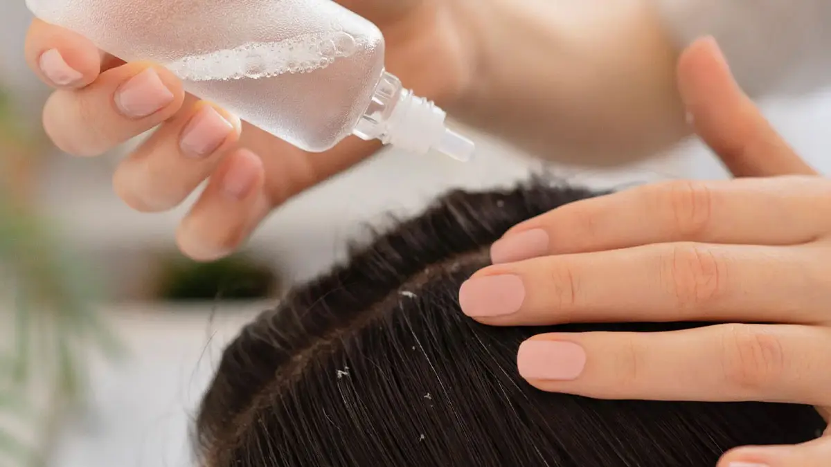 درمان شوره سر با نمک