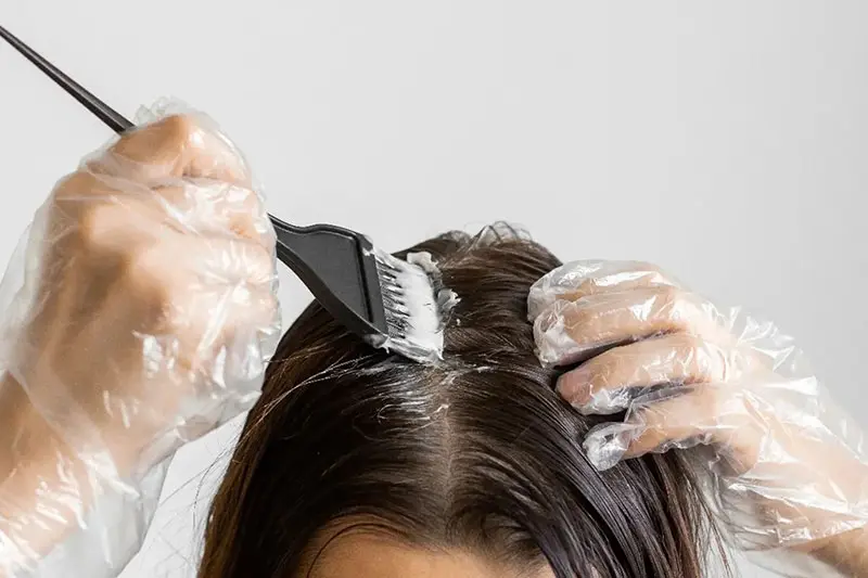 شوره سر چیست و چرا ایجاد میشود؟