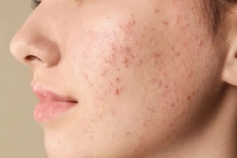 شستن صورت در زمان نامناسب