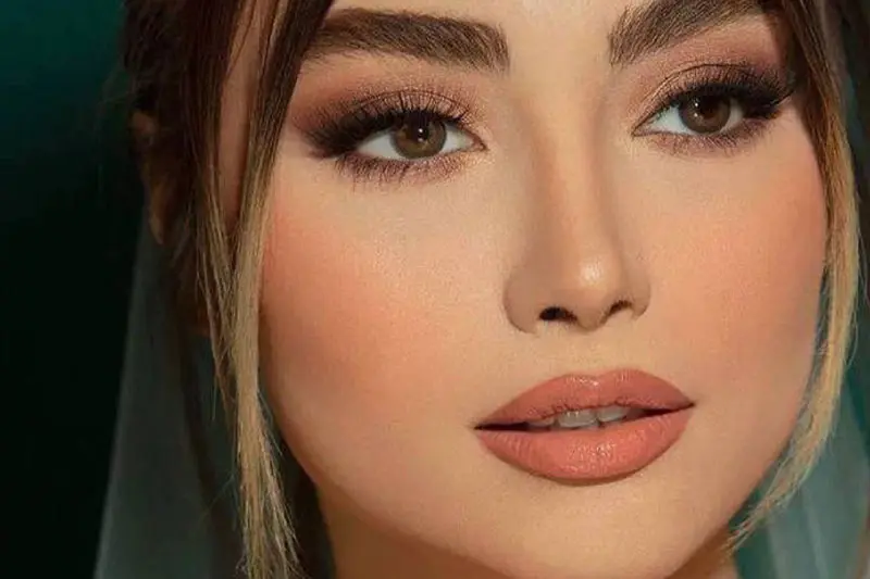 ویژگیهای مهم آرایش نود