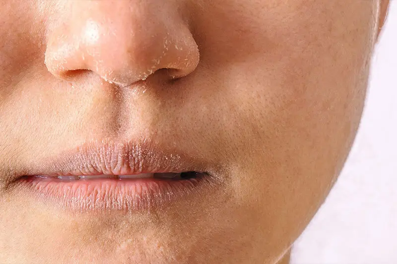 - بهترین ترکیبات کرم برای پوست خشک 4