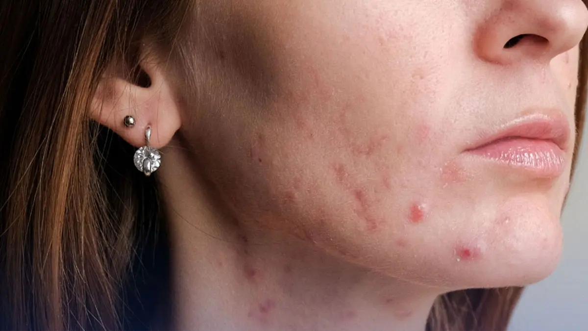 - جوشهای ۲۰ سالگی 1