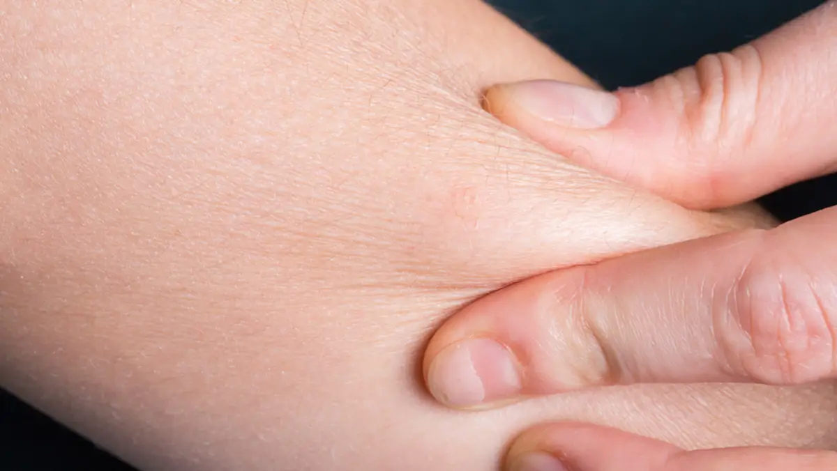 - خشکی پوست بعد حمام 1