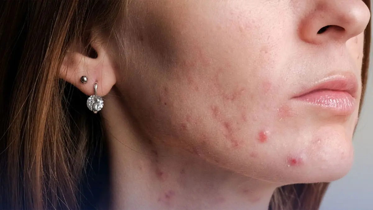 - جوش بعد از اصلاح 1