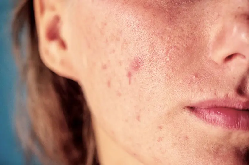 - جوش بعد از اصلاح 2