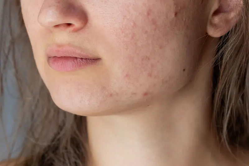 - جوش بعد از اصلاح 3