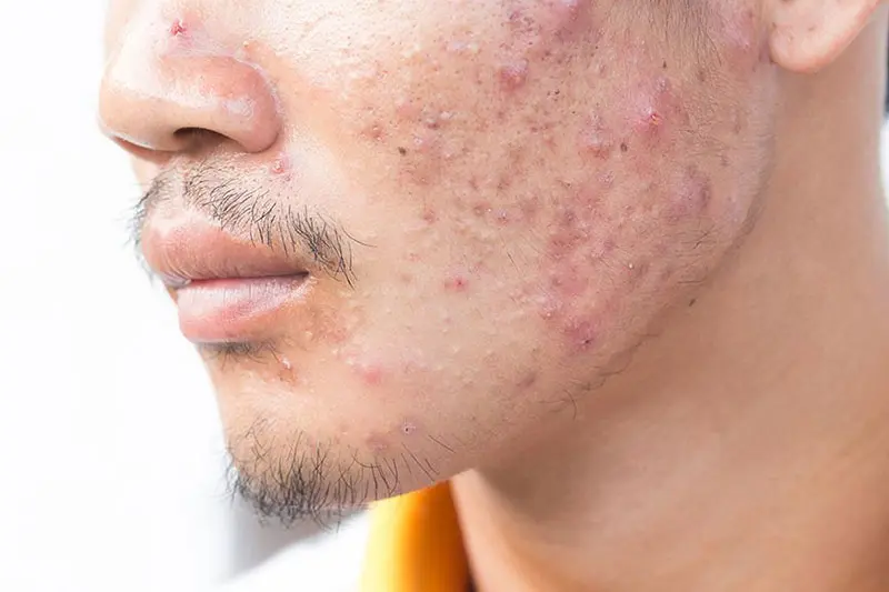 نکات ایمنی و آزمایش نقطهای قبل از استفاده