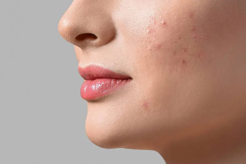 سرم اقتصادی