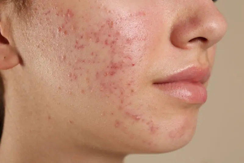 زمان مراجعه به متخصص