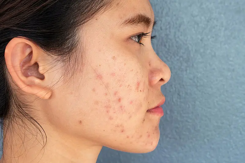 مراقبت روزانه از پوست را به یک عادت تبدیل کنید