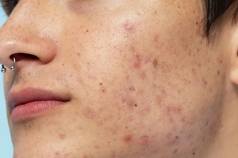 جوشها را نترکانید