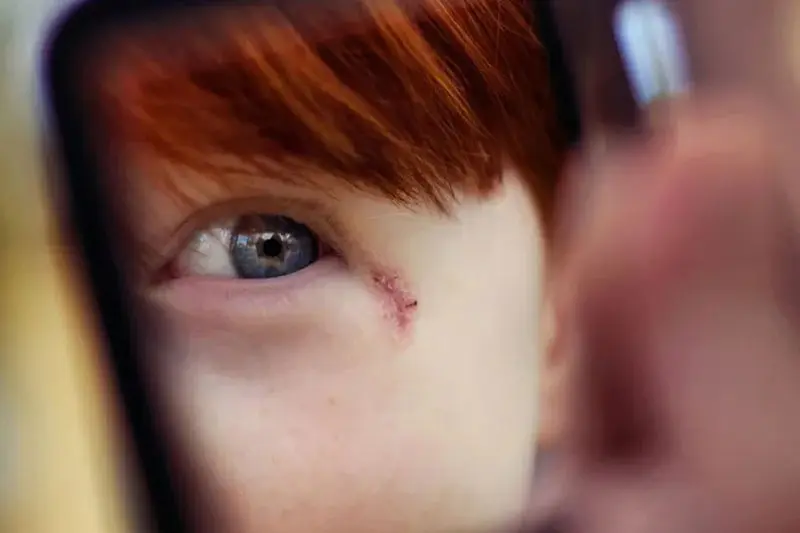 - مخفی کردن جای زخم با میکاپ 3