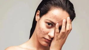 بهترین روغن گیاهی برای جای جوش