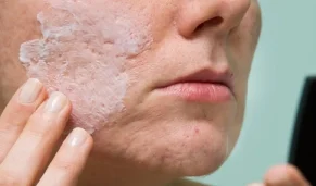 تاثیر اسید سالیسیلیک بر پوست